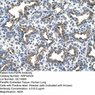 ARP44528_P050 - Podoplanin
