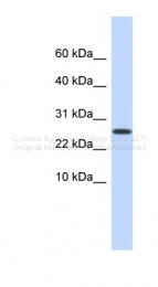 ARP44530_P050 - Podoplanin
