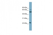 ARP44533_P050 - Dectin-2