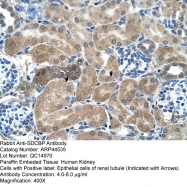 ARP44535_T100 - Syntenin-1 / SDCBP