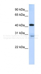 ARP44634_P050 - GRAMD2