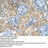 ARP44683_T100 - TM9SF1