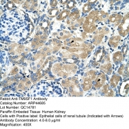 ARP44685_T100 - TM9SF1