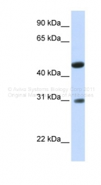 ARP44686_P050 - GLTPD2