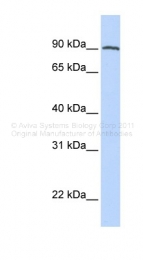 ARP44691_P050 - PSMA / FOLH1
