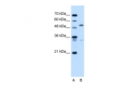 ARP44729_T100 - Podocalyxin / PODXL