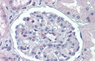 ARP44730_P050 - Podocalyxin / PODXL