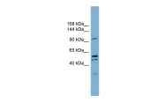 ARP44761_P050 - Anoctamin-6