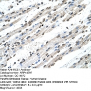 ARP44797_T100 - RCE1