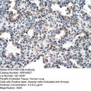 ARP44827_T100 - FAM134B