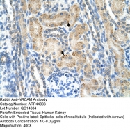 ARP44833_T100 - NRCAM