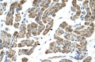 ARP45040_P050 - Activin receptor type 1 / ACRV1