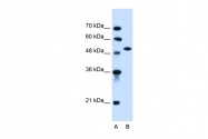 ARP45040_P050 - Activin receptor type 1 / ACRV1