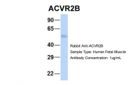 ARP45041_P050 - Activin receptor type 2B / ACVR2B