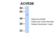 ARP45041_P050 - Activin receptor type 2B / ACVR2B