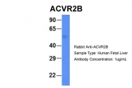 ARP45041_P050 - Activin receptor type 2B / ACVR2B