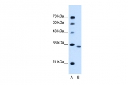 ARP45043_P050 - Activin receptor type 2B / ACVR2B