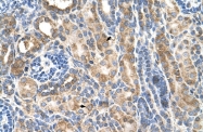 ARP45170_T100 - Cadherin-3