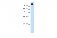 ARP45170_T100 - Cadherin-3
