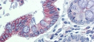 ARP45198_P050 - Desmoglein-2
