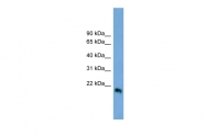 ARP45228_P050 - IFNB / Interferon beta