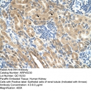 ARP45230_T100 - Indian hedgehog protein / IHH