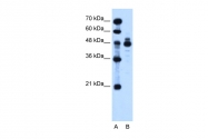 ARP45230_T100 - Indian hedgehog protein / IHH
