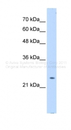 ARP45363_P050 - PTPN2 / TCPTP