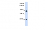 ARP45435_P050 - Synaptophysin / SYP