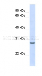 ARP45454_P050 - Tetraspanin-6 (TSPAN6)