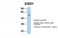 ARP45592_P050 - Estrogen receptor alpha