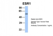 ARP45592_P050 - Estrogen receptor alpha