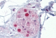 ARP45593_P050 - Glucocorticoid receptor