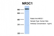 ARP45593_P050 - Glucocorticoid receptor