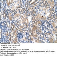 ARP45599_T100 - Mineralocorticoid receptor
