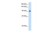 ARP45599_T100 - Mineralocorticoid receptor