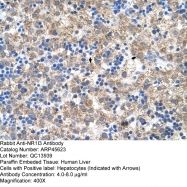 ARP45623_T100 - NR1I3 / CAR