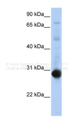 ARP45636_P050 - NR0B2
