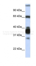 ARP45671_P050 - Arginase-1