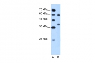 ARP45672_T100 - Arginase-1