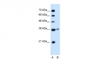 ARP45673_T100 - Arginase-1