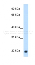 ARP45678_T100 - KLKB1 / Kininogen