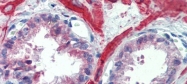 ARP45685_P050 - IGFBP4