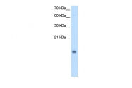 ARP45749_P050 - Cystatin-B