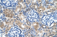 ARP45752_T100 - Superoxide Dismutase 1 / SOD1