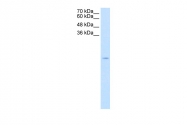 ARP45752_T100 - Superoxide Dismutase 1 / SOD1