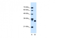 ARP45801_T100 - Carbonyl reductase 1