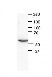 ARP45826_P050 - CAF-1 subunit B
