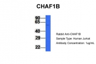 ARP45826_P050 - CAF-1 subunit B