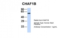ARP45826_P050 - CAF-1 subunit B